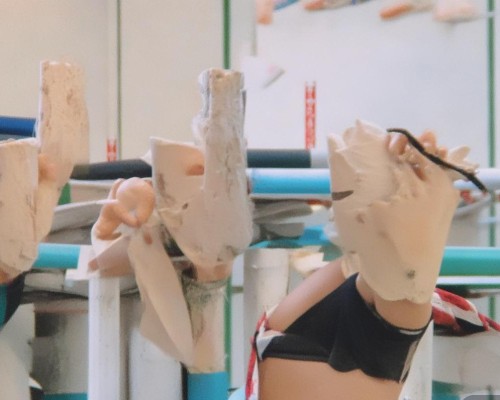 嗯，用户让我写一篇关于包膜挛缩的文章，标题和内容都要写。首先，我得弄清楚什么是包膜挛缩。包膜挛缩听起来像是一个医学术语，可能和某些疾病有关。我应该先查一下这个词的具体定义