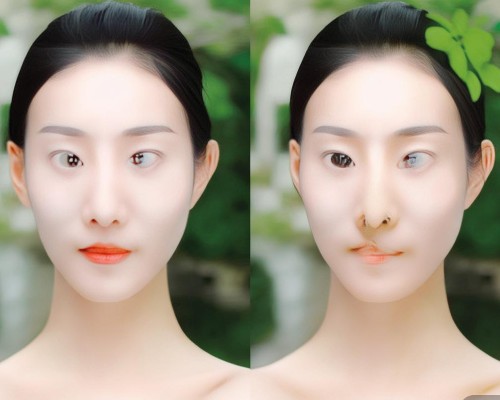 鼻综合手术风险有哪些？全面解析与应对策略